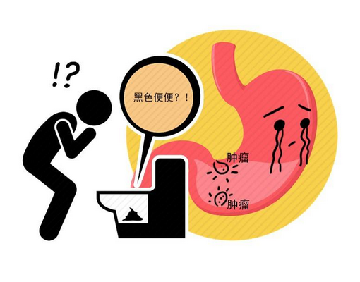 平时不痛不痒,咋突然就患了胃癌?警惕:身上4个警报,为何一次次放走了