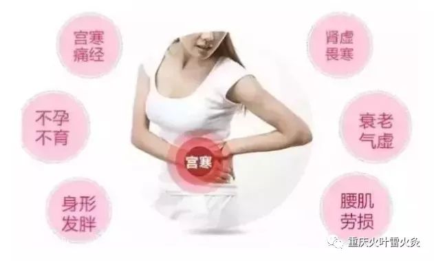 雷火灸改善宫寒做暖宫娘娘
