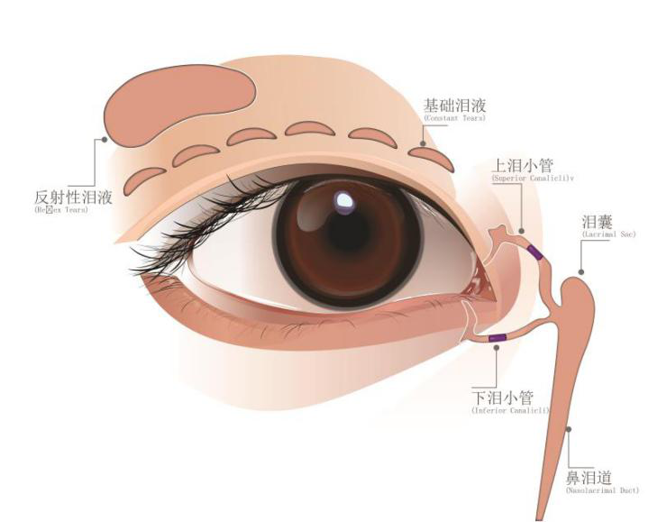 泪道栓塞治疗干眼患者的福音