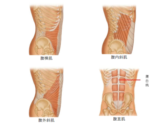 腹直肌分离,实质上是因为腹内外斜肌和腹横肌受到过度牵拉,导致其筋膜