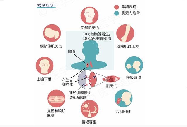 北京崇文门痿症科殷世荣重症肌无力患者如何正确饮食