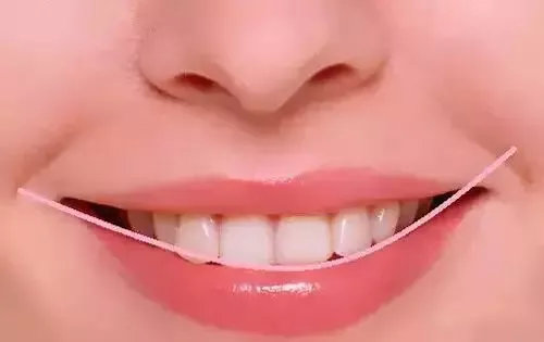 那么排除了颜色之后,究竟什么才是漂亮牙齿的标准呢?