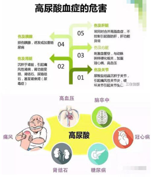 尿酸偏高的原因及治疗方法你都知道哪些