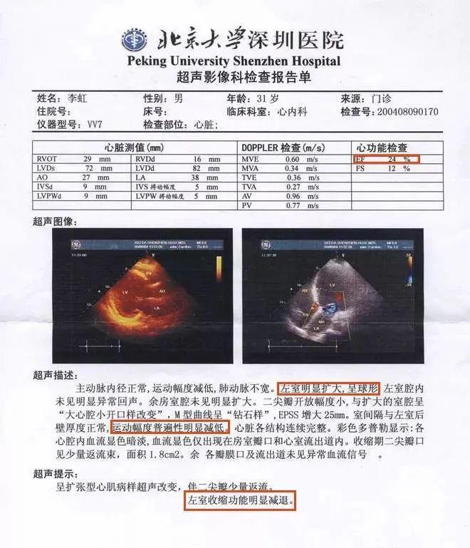 北大休学公司辞退医院抢救我背着罕见病生活的47年