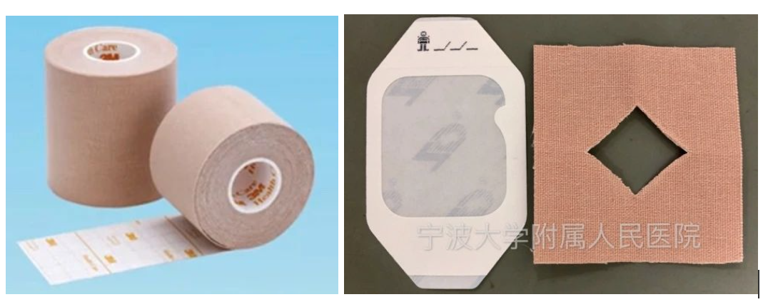 安全又牢固的"窗口贴"固定留置法,视频讲解来了