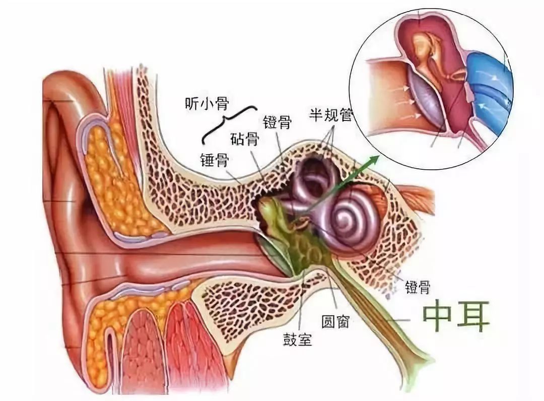 中耳炎是累及中耳(包括咽鼓管,鼓室,鼓窦及乳突气房)全部或部分结构