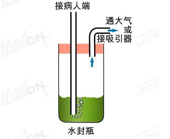 (一)单瓶水封瓶