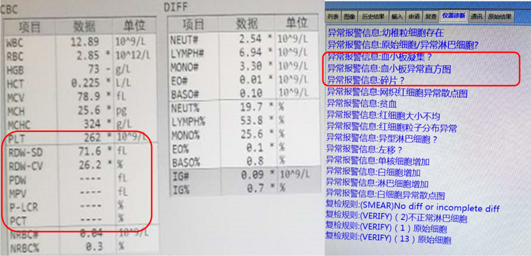 9 /l,血小板相关的计算参数(血小板分布宽度(pdw),平均血小板体积