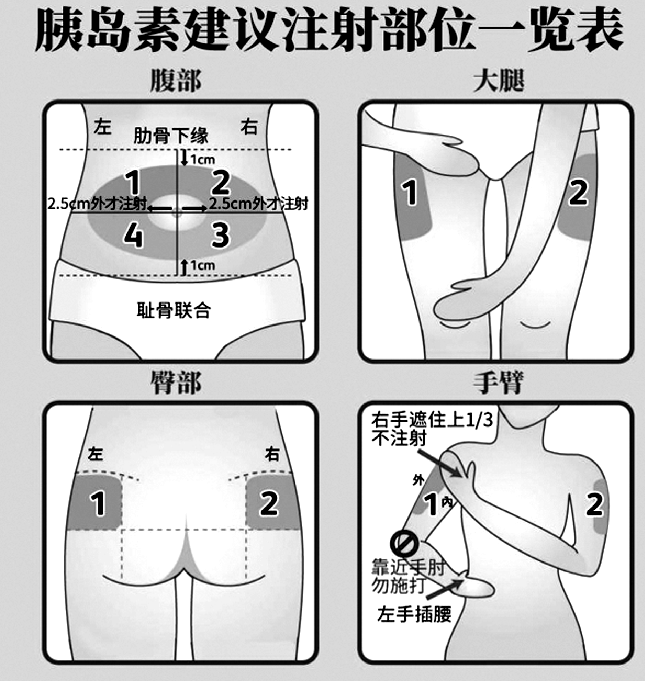 针头越长,打针时打到肌肉的风险越高.