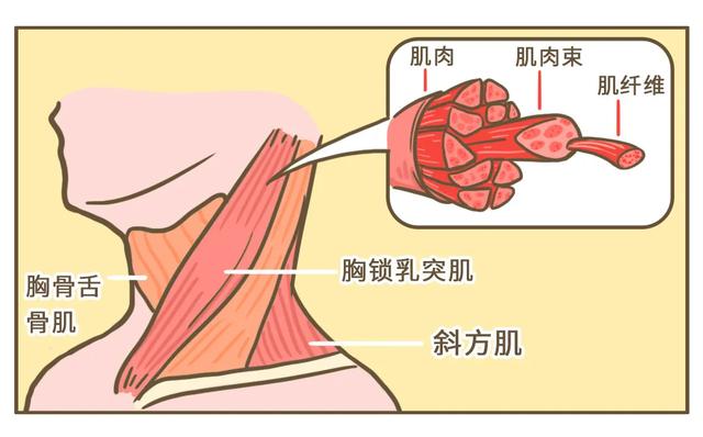 「星医百」落枕,是脖子在喊救命