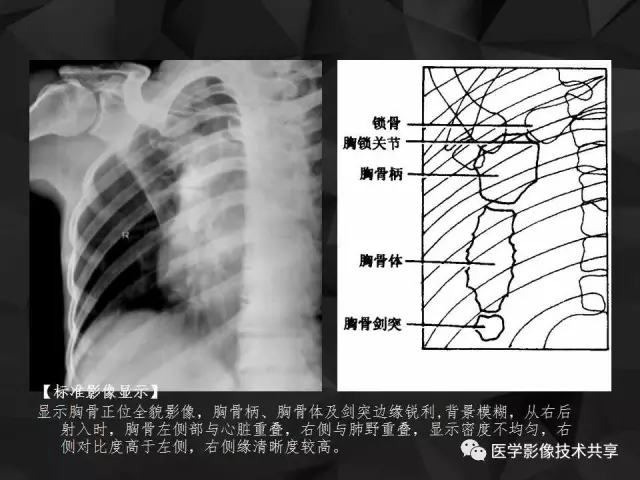 各部位普通x线摄影技术二