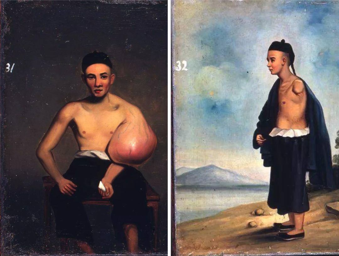 谁给中国带来了现代医院