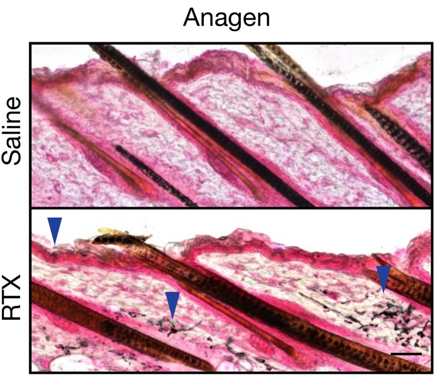 伍子胥为何一夜白头？科学家从老鼠那得到了答案