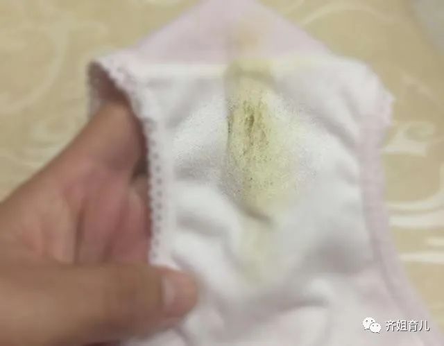 怀孕期间的女性雌性激素会大量分泌, 白带也会因此增多,内裤上总会湿