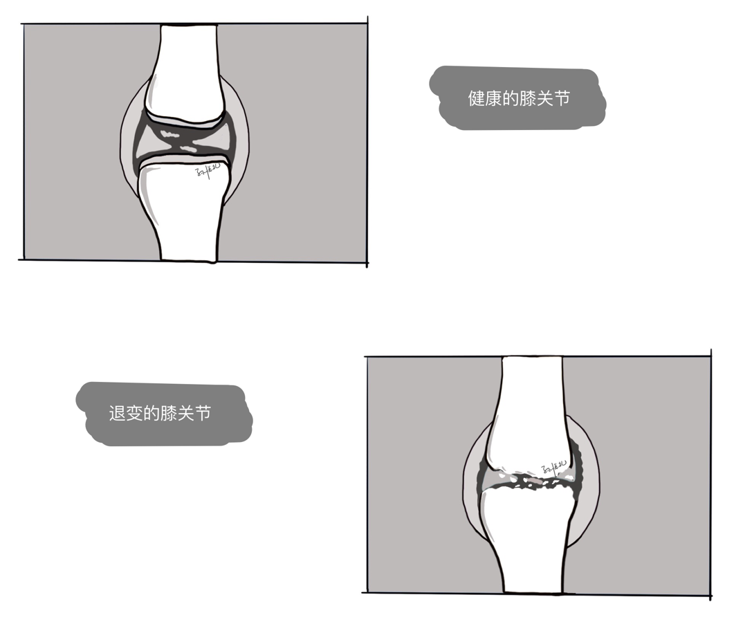 膝关节发凉别只知道保暖