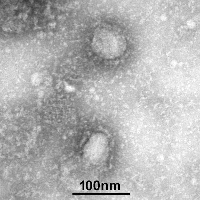 病原微生物资源库公布首株新型冠状病毒毒种信息