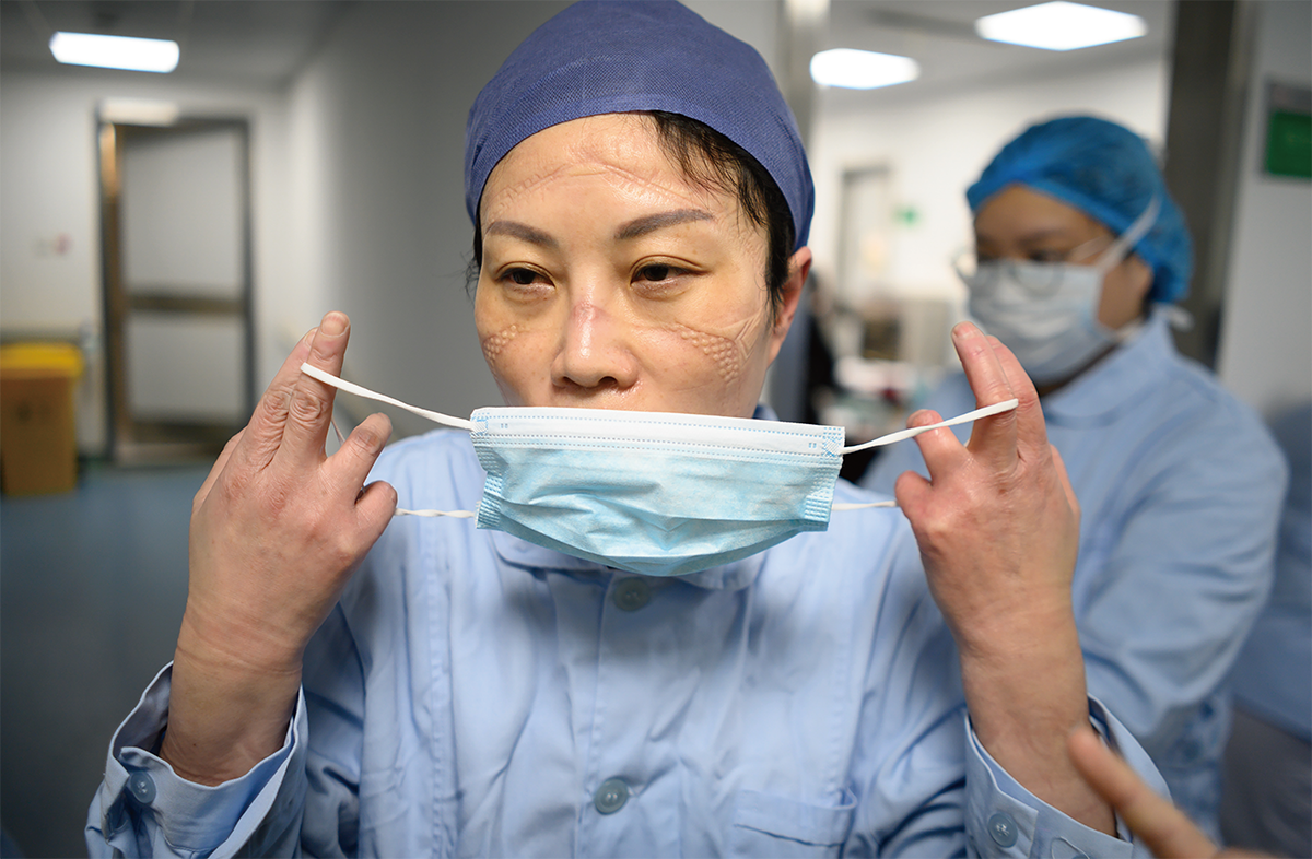 护士李冬梅连续工作8小时后摘下口罩,脸上有护目镜留下的深深压痕.