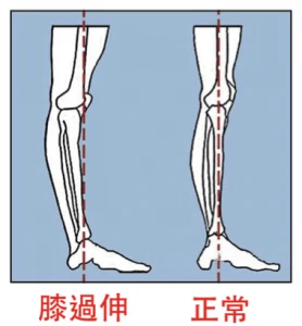 你居然有四个膝盖?