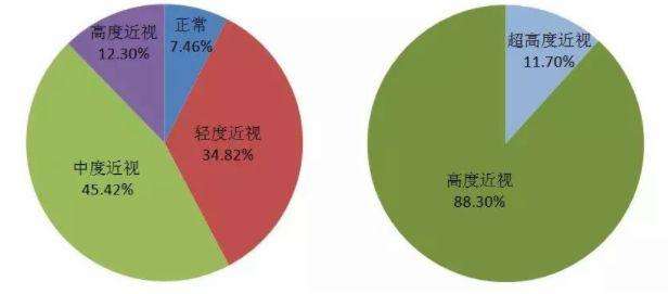 首大眼科聂红平:近视"发展"快的主要有原因有哪些?