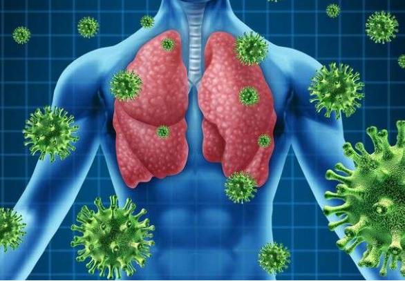 肺癌会引起肩痛,背痛,互不相干的部位,为何会有连带反应?