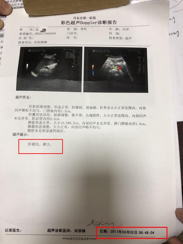 钟伟医生健康谈肝硬化腹水别放弃治疗中医治疗有效