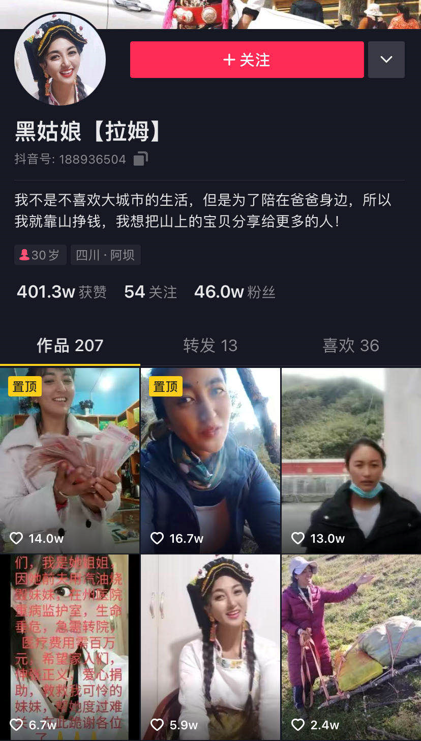 网红拉姆直播时被前夫烧伤,生命垂危