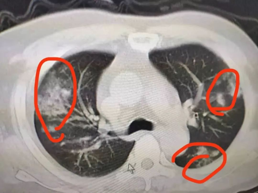 武汉医生工作见闻：下了班，我还得帮科室抢物资