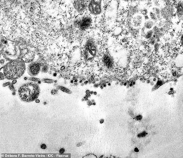 巴西科学家用放大200万倍显微镜首次抓拍新冠病毒感染