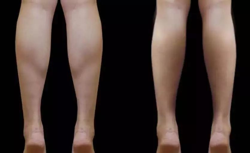 躺着就能瘦腿的方法真的存在吗?