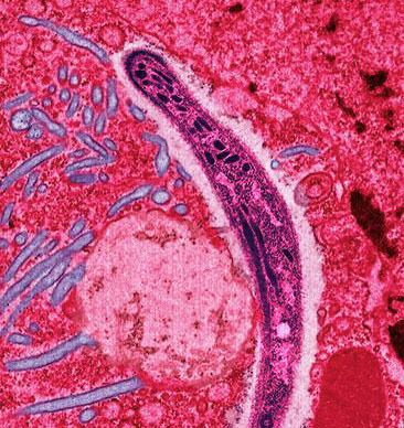 传染病上战场，比炮弹更凶猛 | 地球知识局