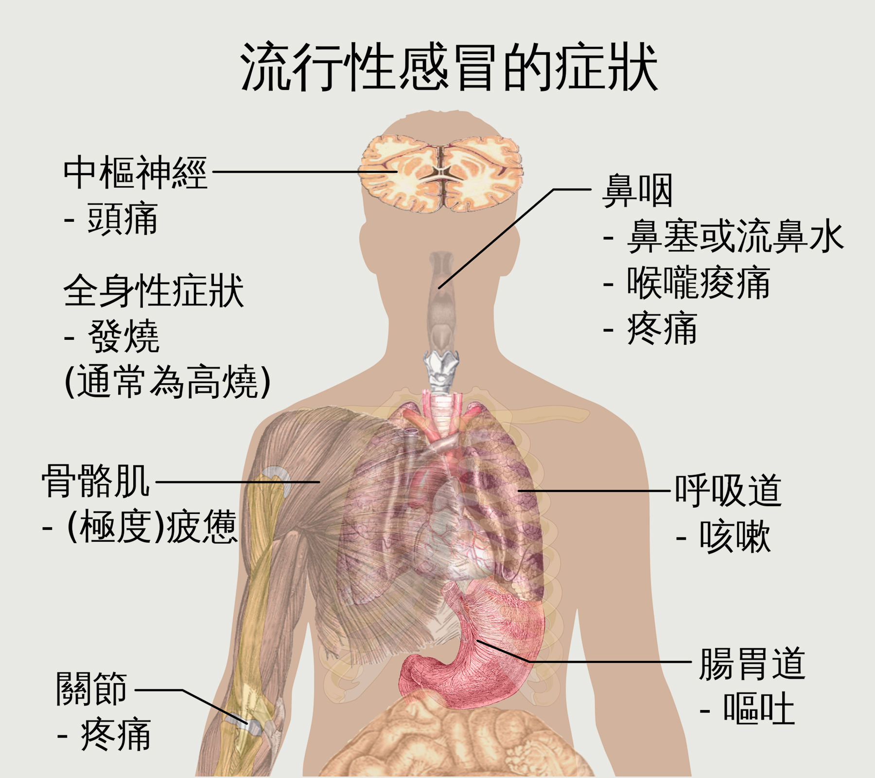 美国流感何以发展至此？| 地球知识局