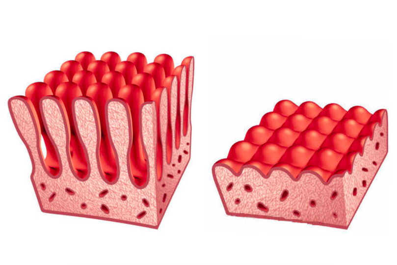小肠黏膜对比图