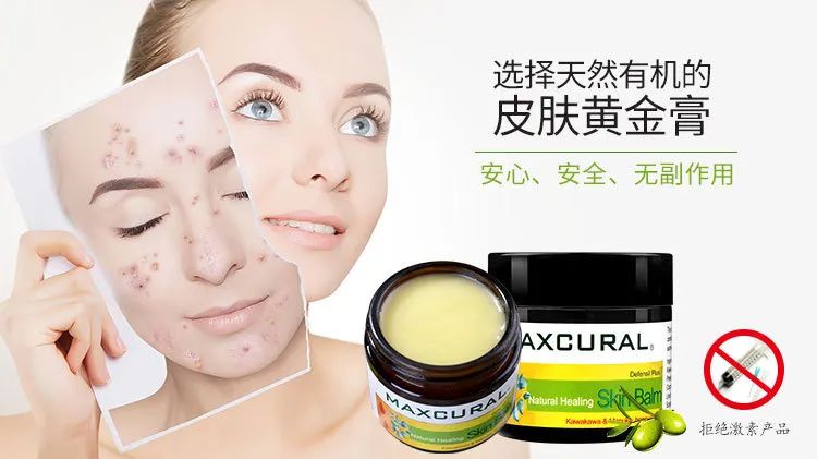 皮炎,湿疹,烫伤,止痒修复,新西兰神奇黄金膏一瓶搞定