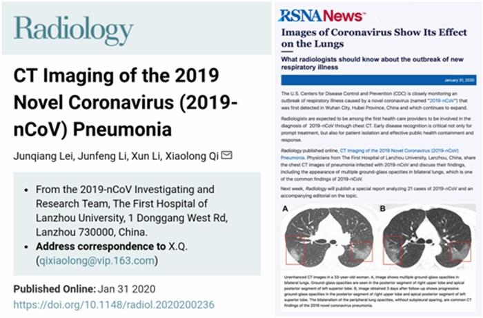 甘肃应对新型冠状病毒感染的肺炎疫情科研攻关取得进展（最新发布）