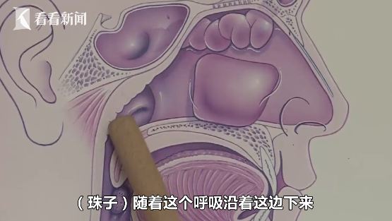 长沙3岁女童模仿"豌豆射手"喷珠子? 结果卡在鼻孔内