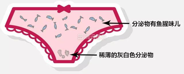 约半数人得了细菌性阴道炎没有任何症状,其他人则可能会有这些表现