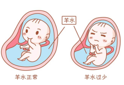 胎儿身上会有一层胎脂包裹,这些胎脂会在胎儿动的过程中脱落到羊水中