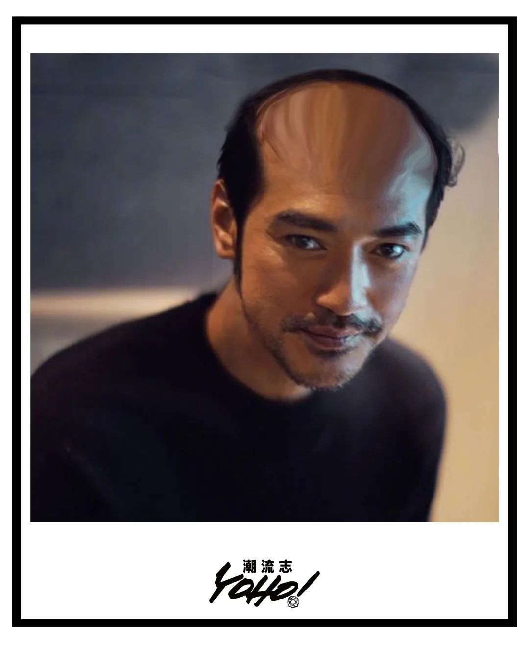 贝克汉姆都逃不过的秃头命运,我还能怎么办