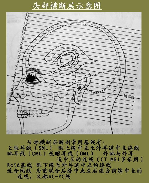 头部横断层解剖图谱(线条图)__凤凰网
