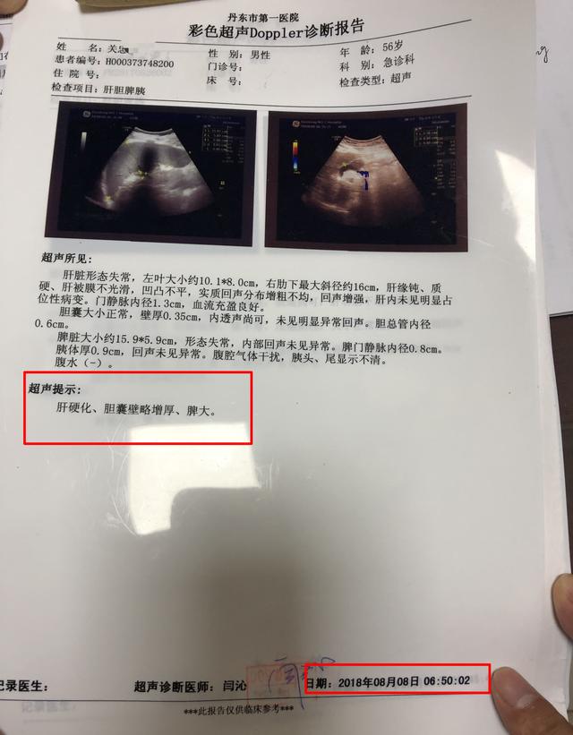 钟伟医生健康谈:肝硬化腹水,别放弃治疗!中医治疗有效