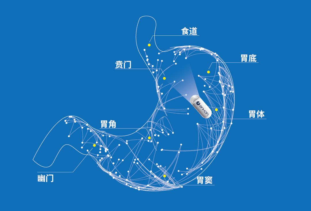 多项临床医学研究证实安翰磁控胶囊胃镜具有优秀的诊断能力