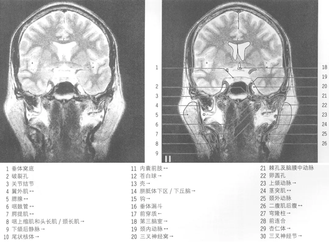 专注分享医学影像干货,是你的影像深造医学院 凤凰精品 放射沙龙salon