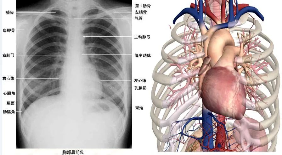 "绿宝书"丨不同体位拍摄的心脏胸片影像