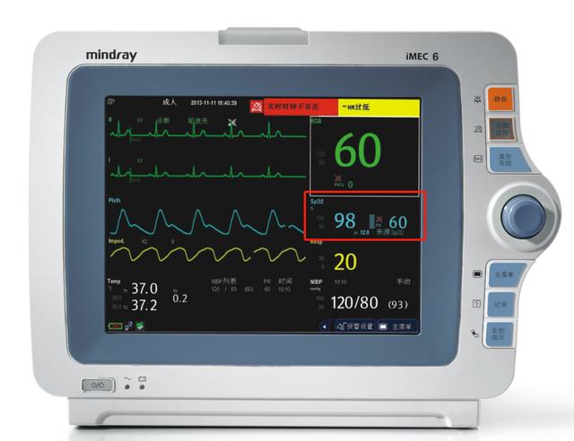 传统上,这个指标需要医院的专业设备,大型监护仪来监测,不必多说.