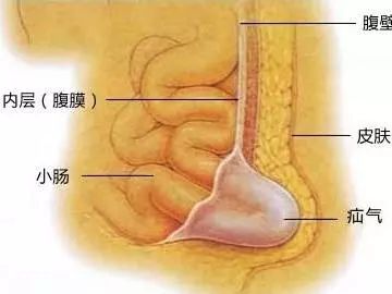 正文  对男人来说,最疼的不是"蛋疼",而是……蛋蛋没了,也就是传说中