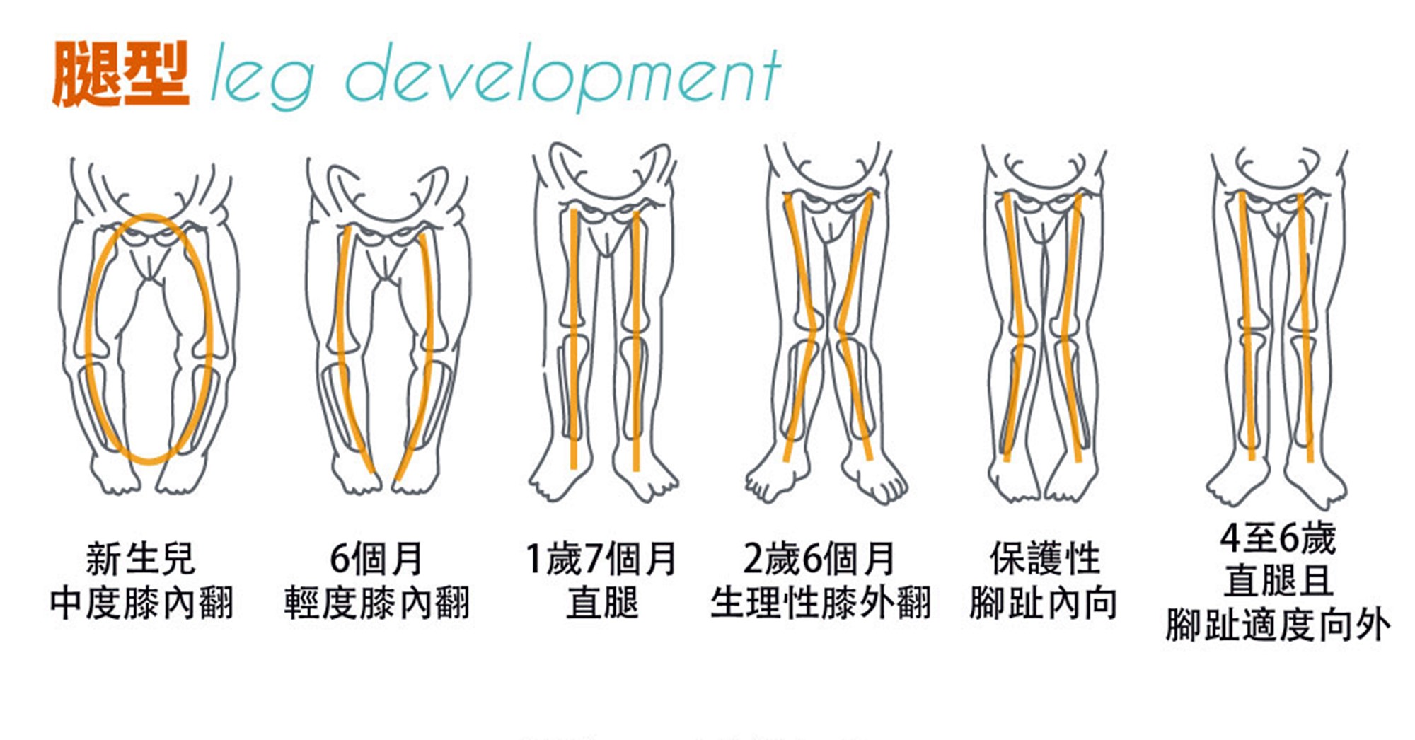 这些育儿陋习有碍宝宝腿部发育,若执迷不悟,活该你娃"小短腿"