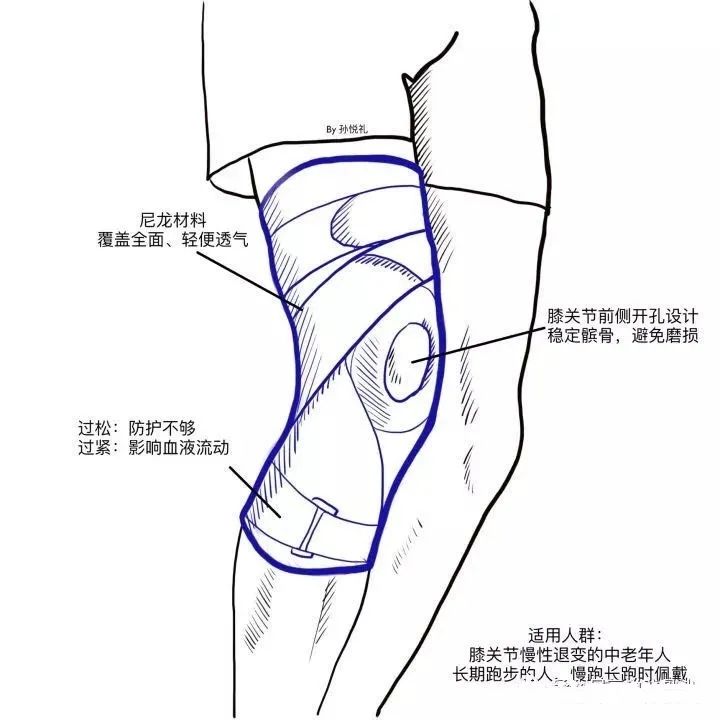 膝盖疼,要不要买个护膝保养?