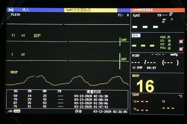 一位抢救失败的患者监护仪数据中心电图变成了直线