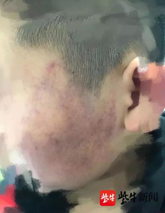老师殴打学生被调离，几十名家长联名求情
