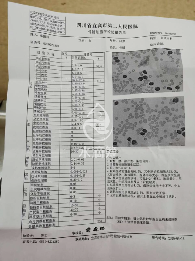 宜宾一名儿子的呐喊:请救救我身患白血病的母亲吧,我还没来得及尽孝啊